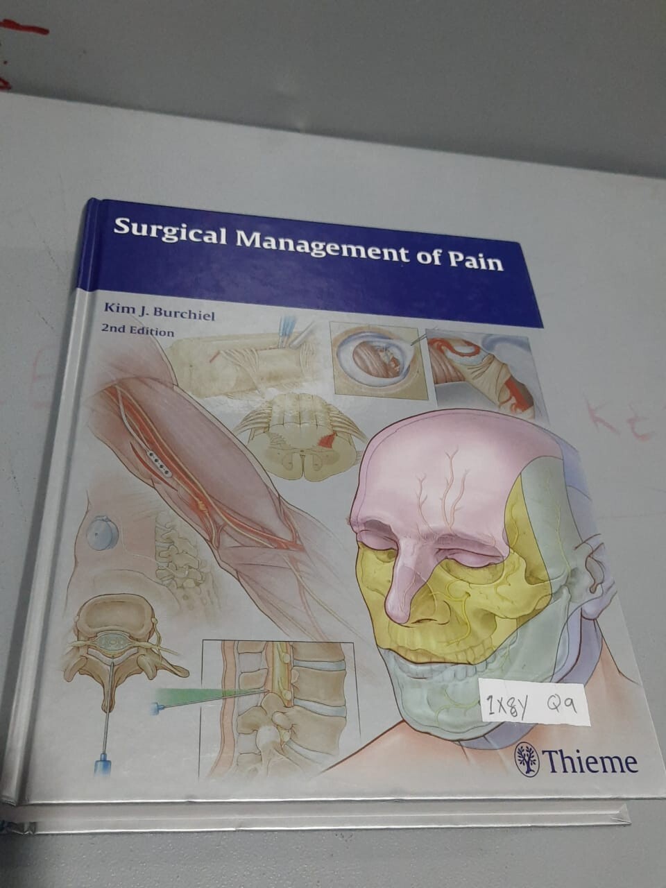 Surgical Management of Pain